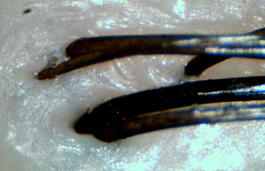 皮膜修復(fù)護(hù)理