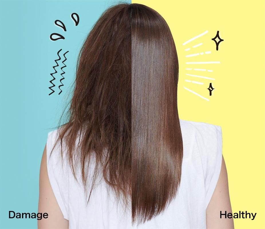 儷真護發(fā)知識：３招解決頭皮屑！